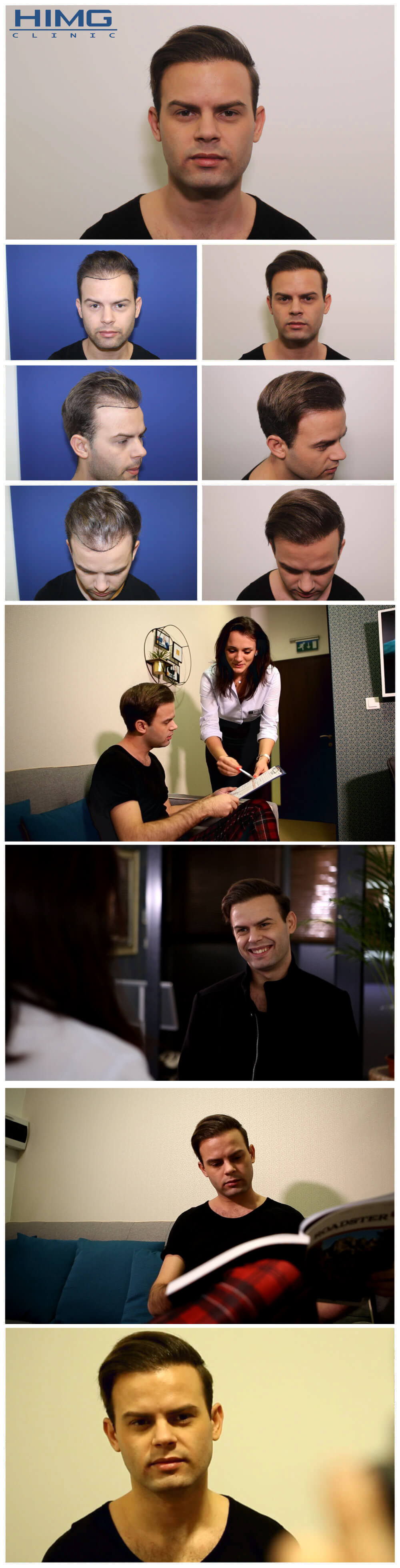 Haartransplantation Vorher - Nachher Bilder - Ergebnisse - Zdroba Patrik Haartransplantation Vorher - Nachher Bilder - Ergebnisse - Zdroba Patrik