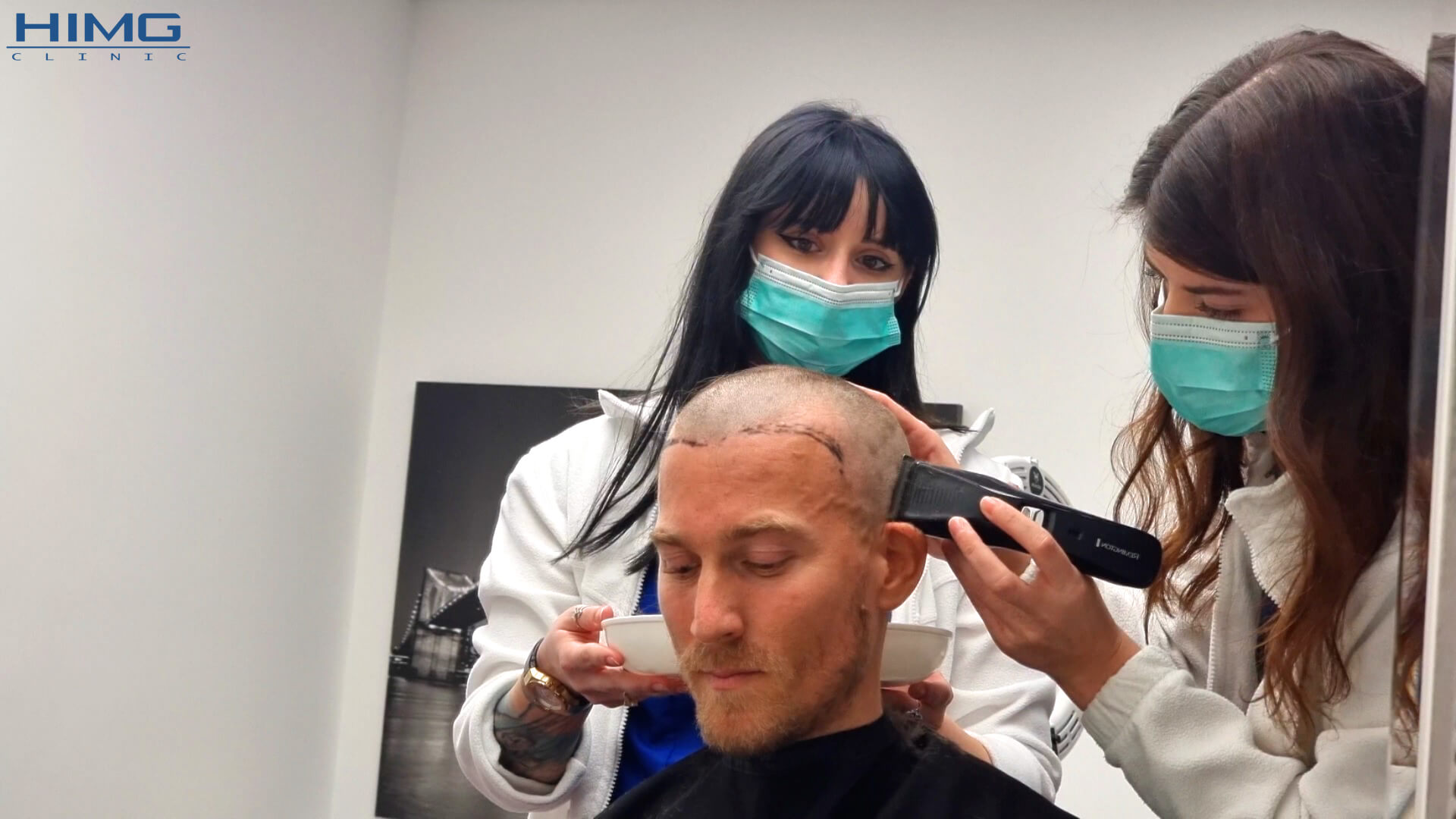 8+1 Mythen über die Haartransplantation 