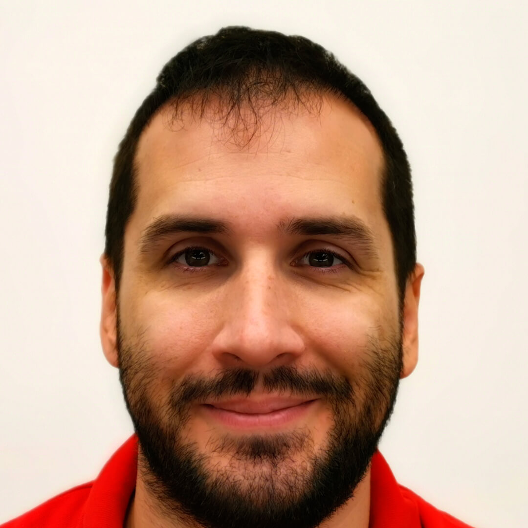 Norbert Kiss - before hair transplant - HIMG Hair Transplant Clinic