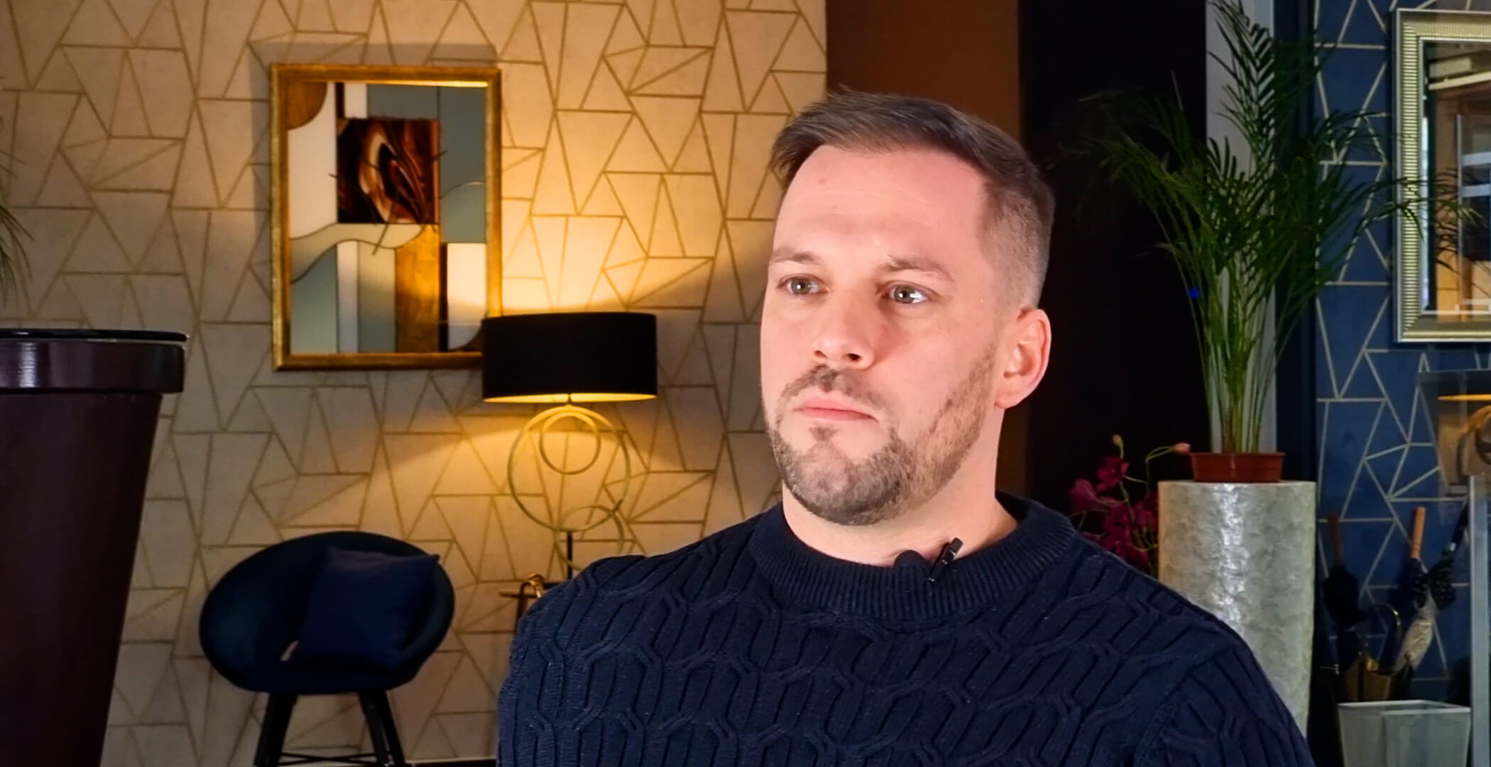 Csuri Ferenc hajbeültetés előtte és utána – HIMG Klinika