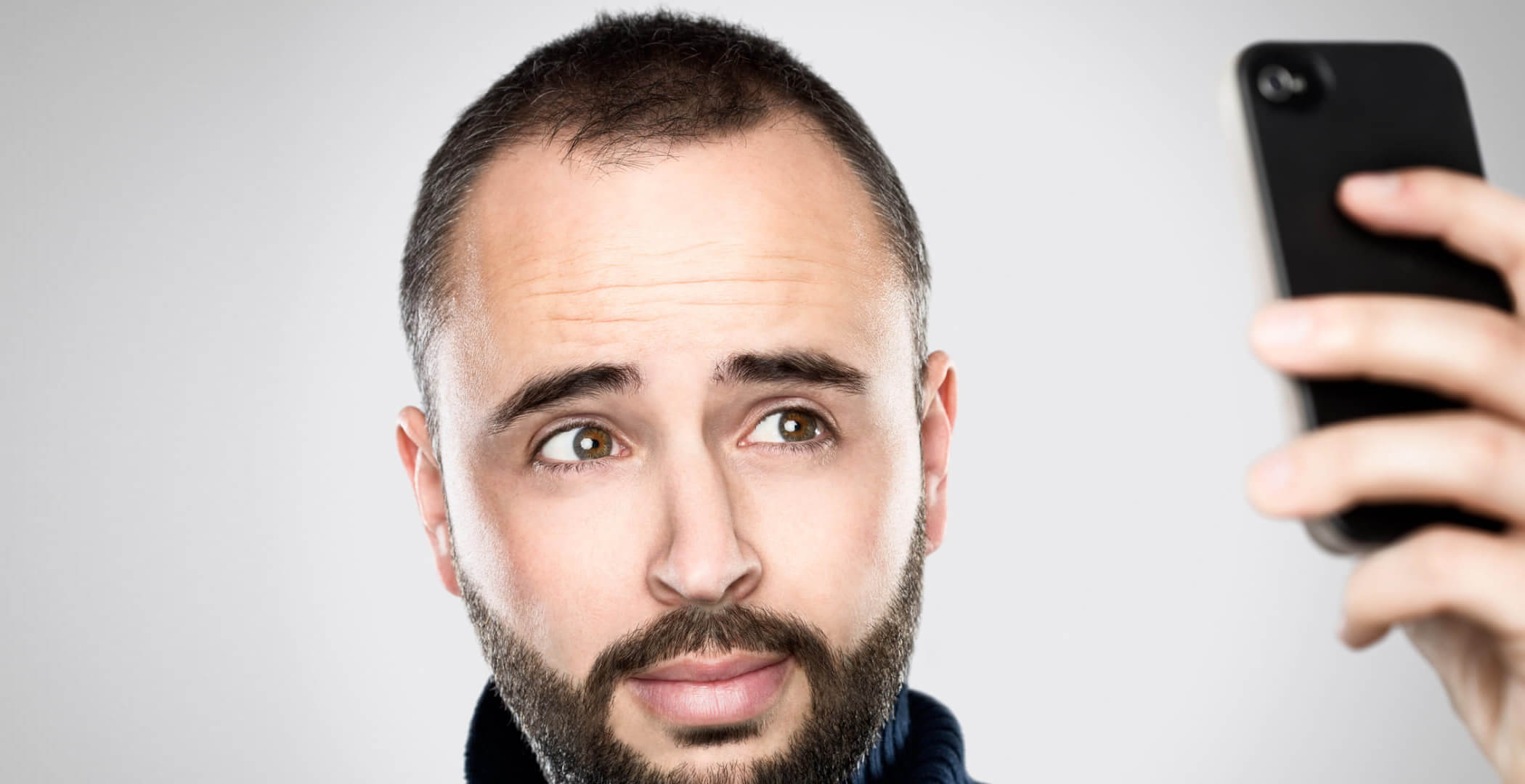 HIMG clinic - Upload Photos for a Free Hair Transplant Quote