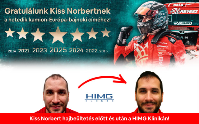Haartransplantation von Norbert Kiss