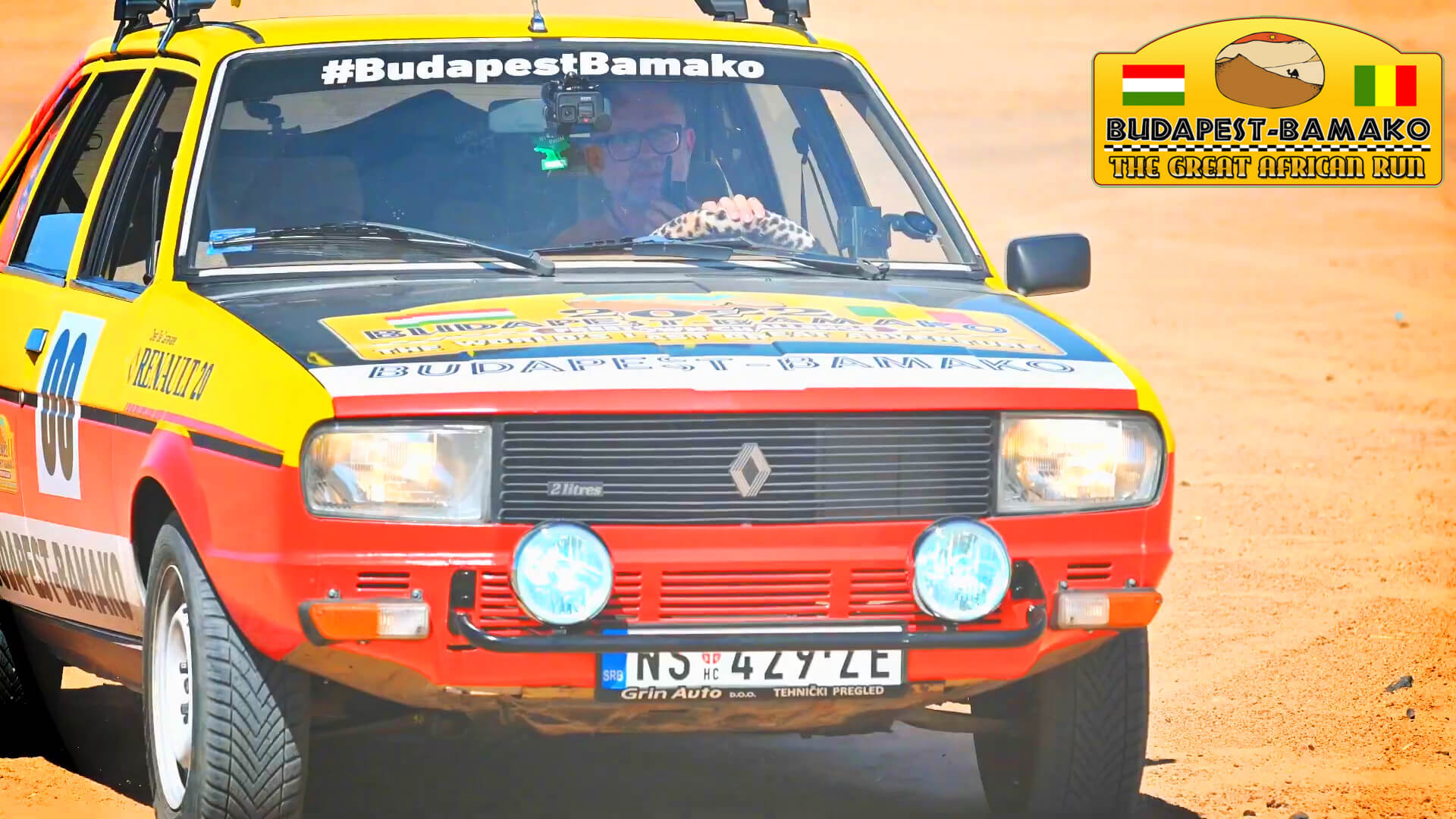 Hajbeültetés előtte-utána fotók - eredmények