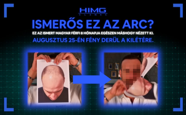  HIMG Klinika 
