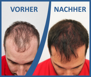  A HIMG Klinika innovatív S.H.E. módszere 