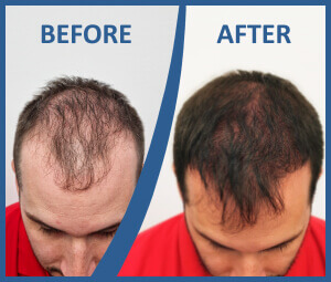  A HIMG Klinika innovatív S.H.E. módszere 