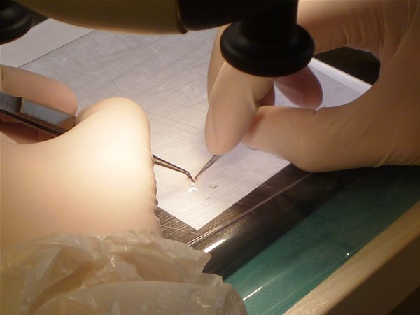 S.H.E. Hair Implantation